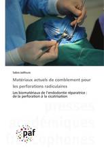 Matériaux actuels de comblement pour les perforations radiculaires
