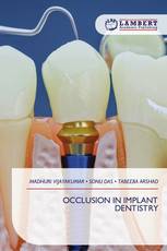 OCCLUSION IN IMPLANT DENTISTRY