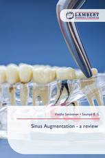 Sinus Augmentation - a review