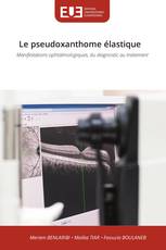 Le pseudoxanthome élastique