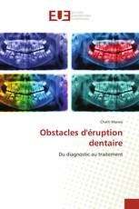 Obstacles d'éruption dentaire