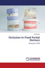 Occlusion In Fixed Partial Denture