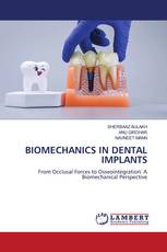 BIOMECHANICS IN DENTAL IMPLANTS