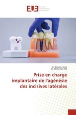 Prise en charge implantaire de l'agénésie des incisives latérales