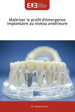Maîtriser le profil d’émergence implantaire au niveau antérieure