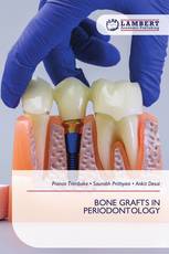 BONE GRAFTS IN PERIODONTOLOGY
