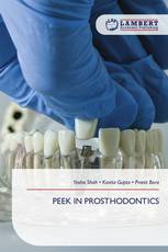PEEK IN PROSTHODONTICS