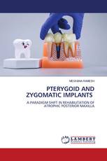 PTERYGOID AND ZYGOMATIC IMPLANTS
