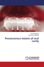 Precancerous lesions of oral cavity
