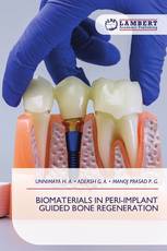 BIOMATERIALS IN PERI-IMPLANT GUIDED BONE REGENERATION