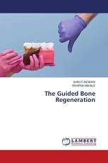 The Guided Bone Regeneration