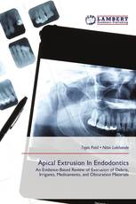 Apical Extrusion In Endodontics