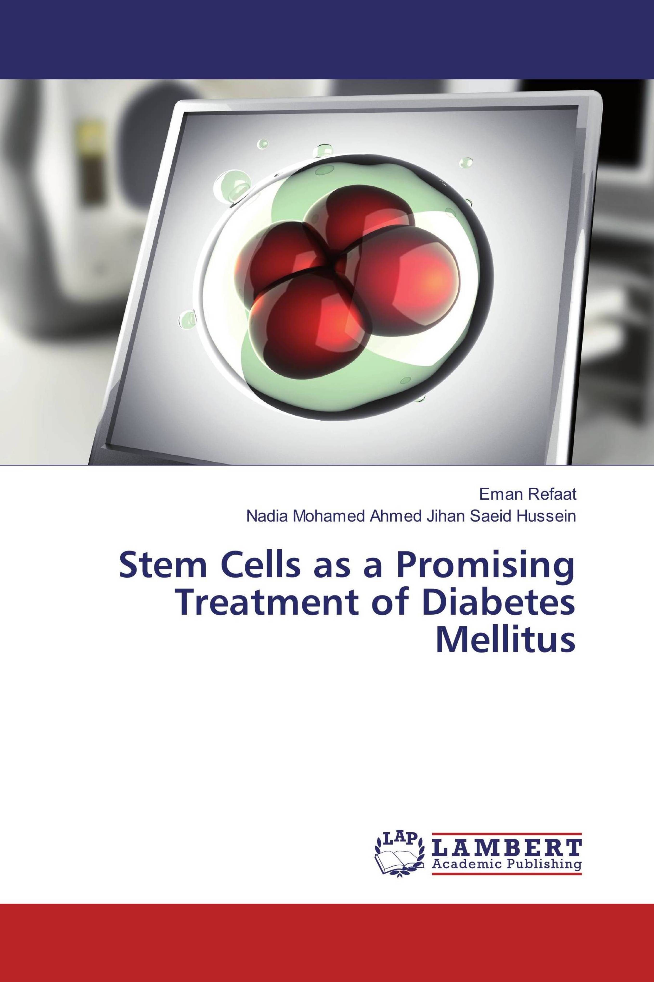Buy Stem Cells as a Promising Treatment of Diabetes Mellitus