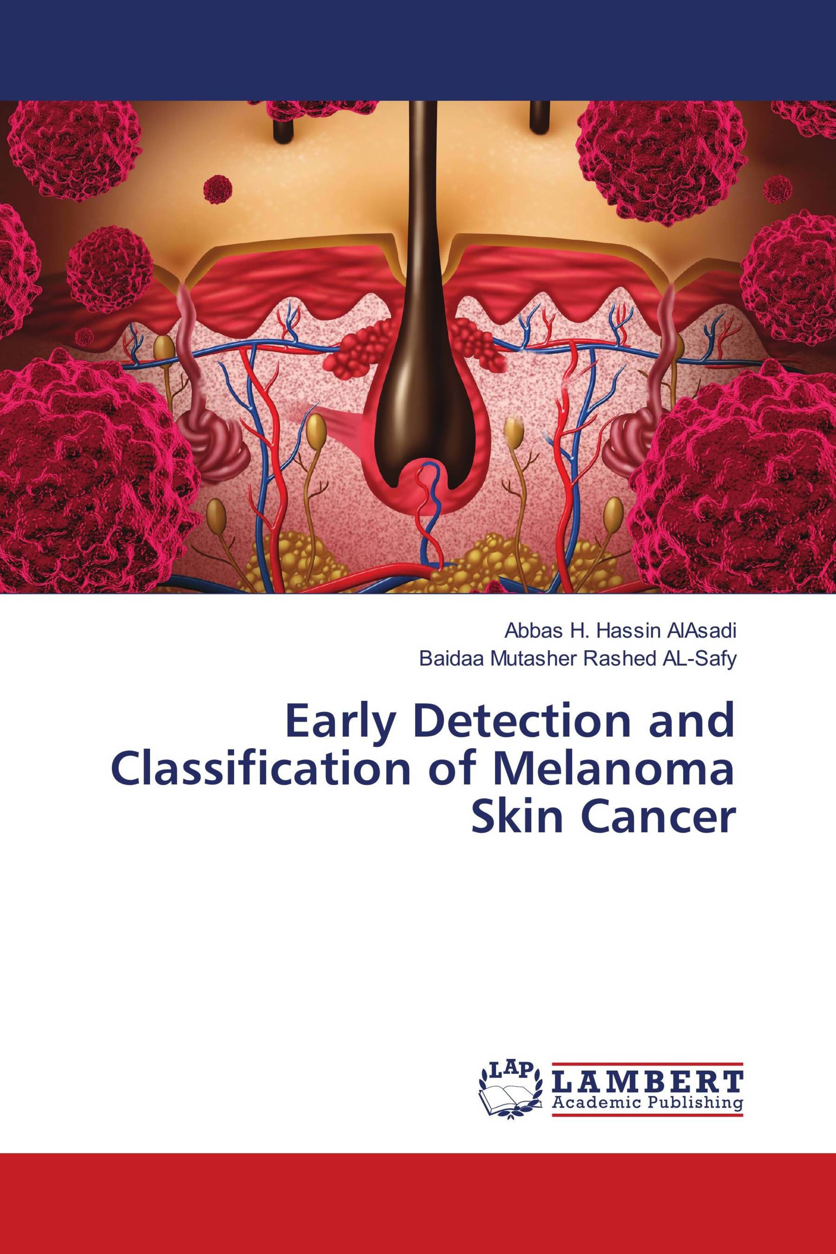 Buy Early Detection and Classification of Melanoma Skin Cancer