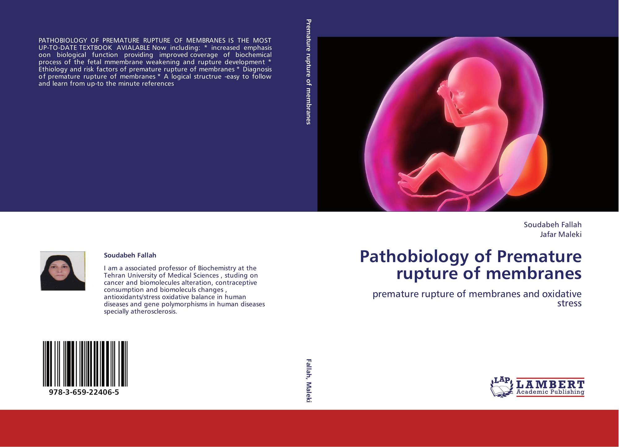 Pathobiology Of Premature Rupture Of Membranes 978 3 659 22406 5 3659224065 9783659224065 By Soudabeh Fallah Jafar Maleki