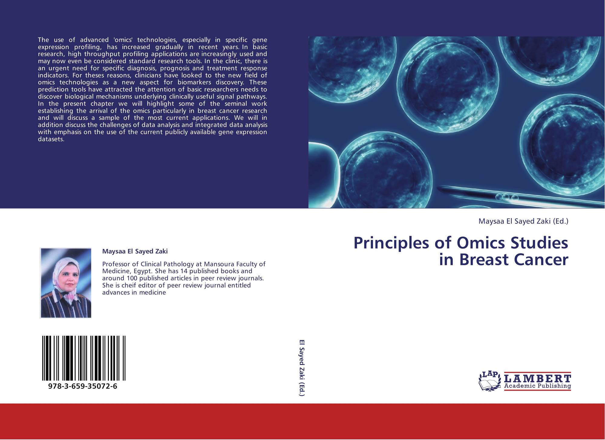 master thesis in breast cancer