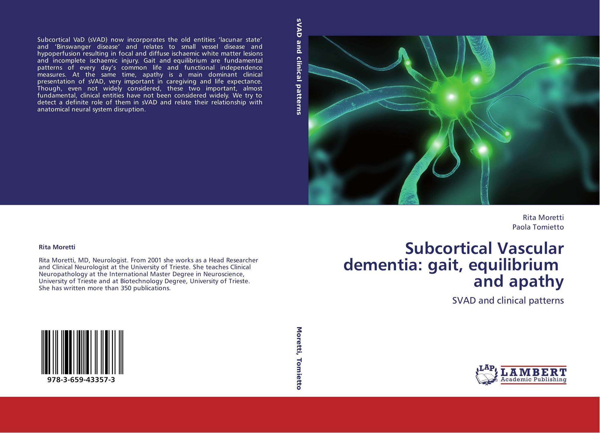 Subcortical Vascular dementia gait, equilibrium and apathy, 9783659