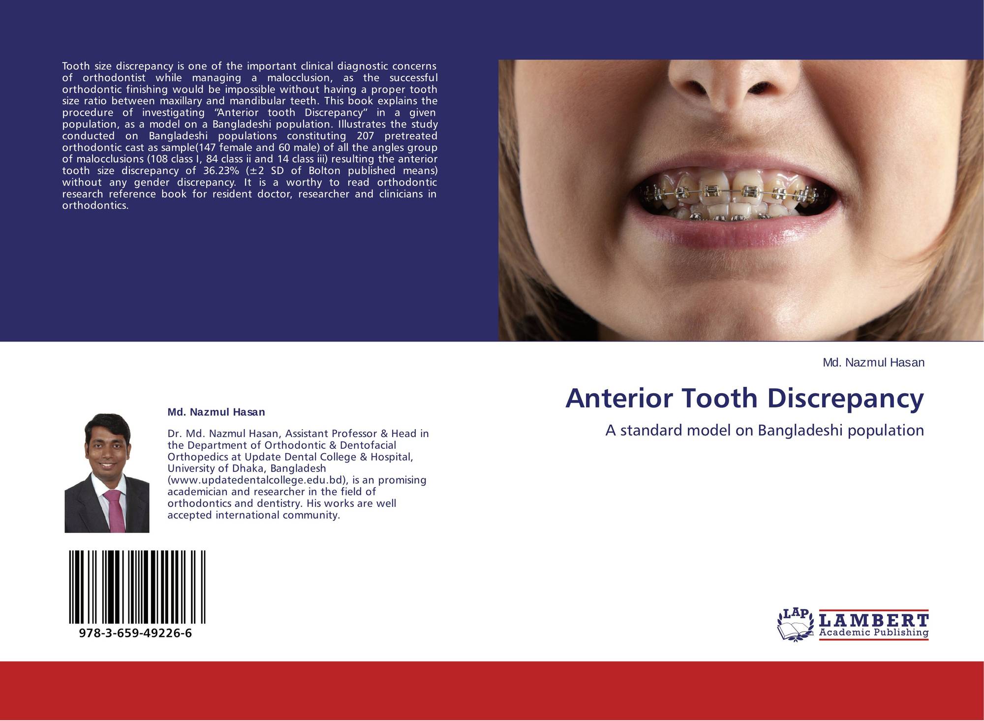 Anterior Tooth Discrepancy 978 3 659 49226 6 3659492264 - 