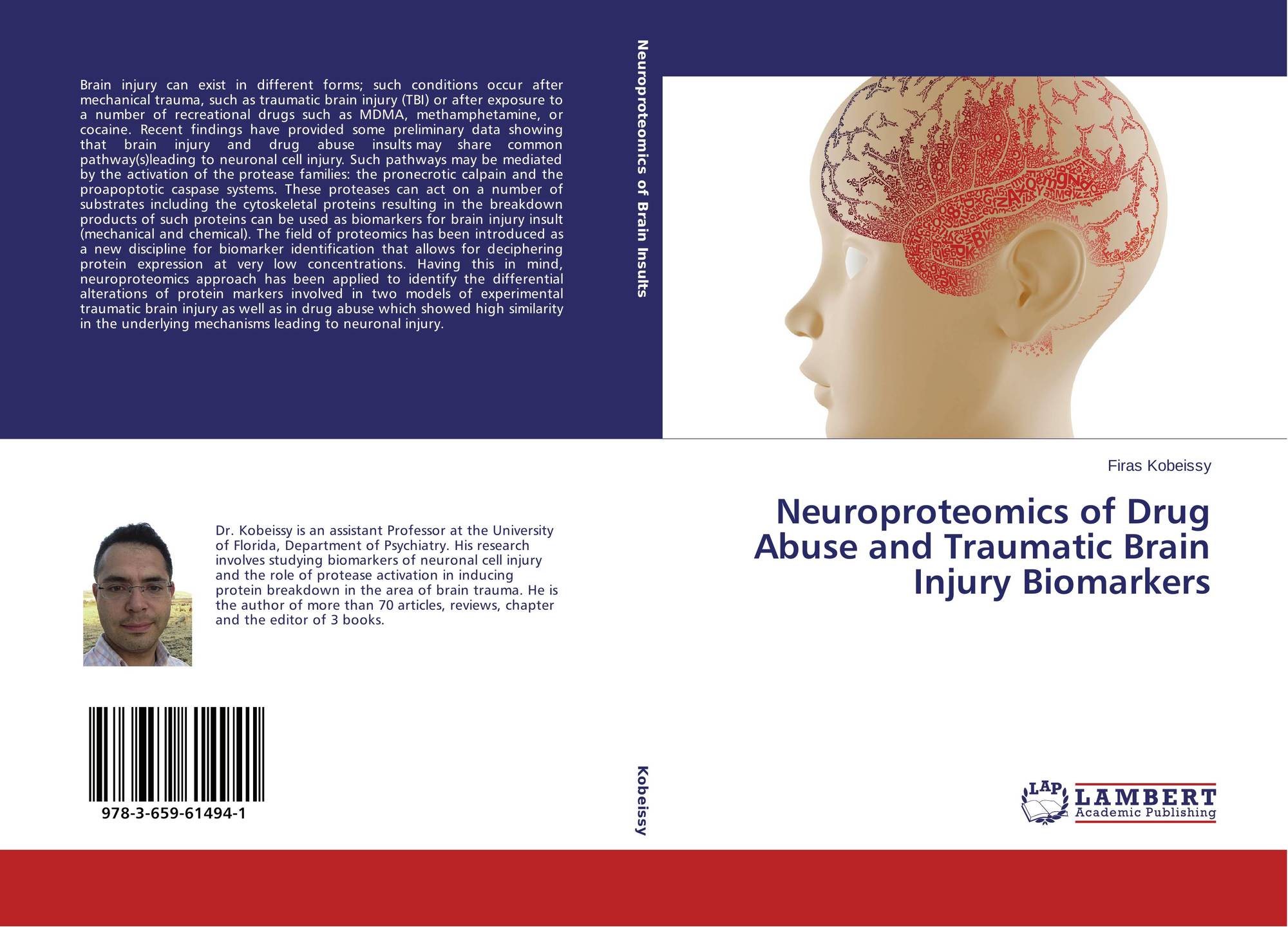 Aquired Brain injury. Best book on Neuropharmacology. Vol. 3 no. 2 (2024): research Journal of Trauma and Disability studies. The photo for presentation about Neuropharmacology.