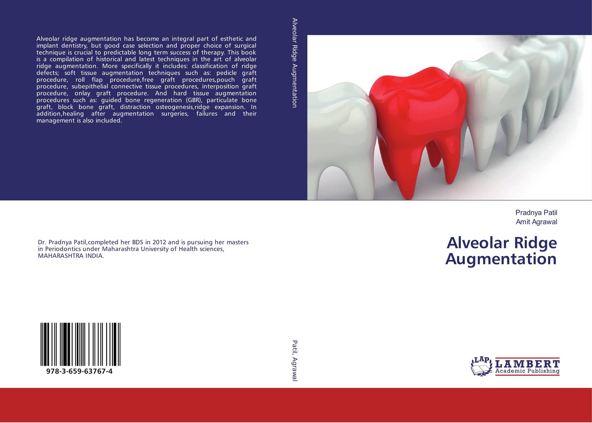 Alveolar Ridge Augmentation 978 3 659 4 x By Pradnya Patil Amit Agrawal