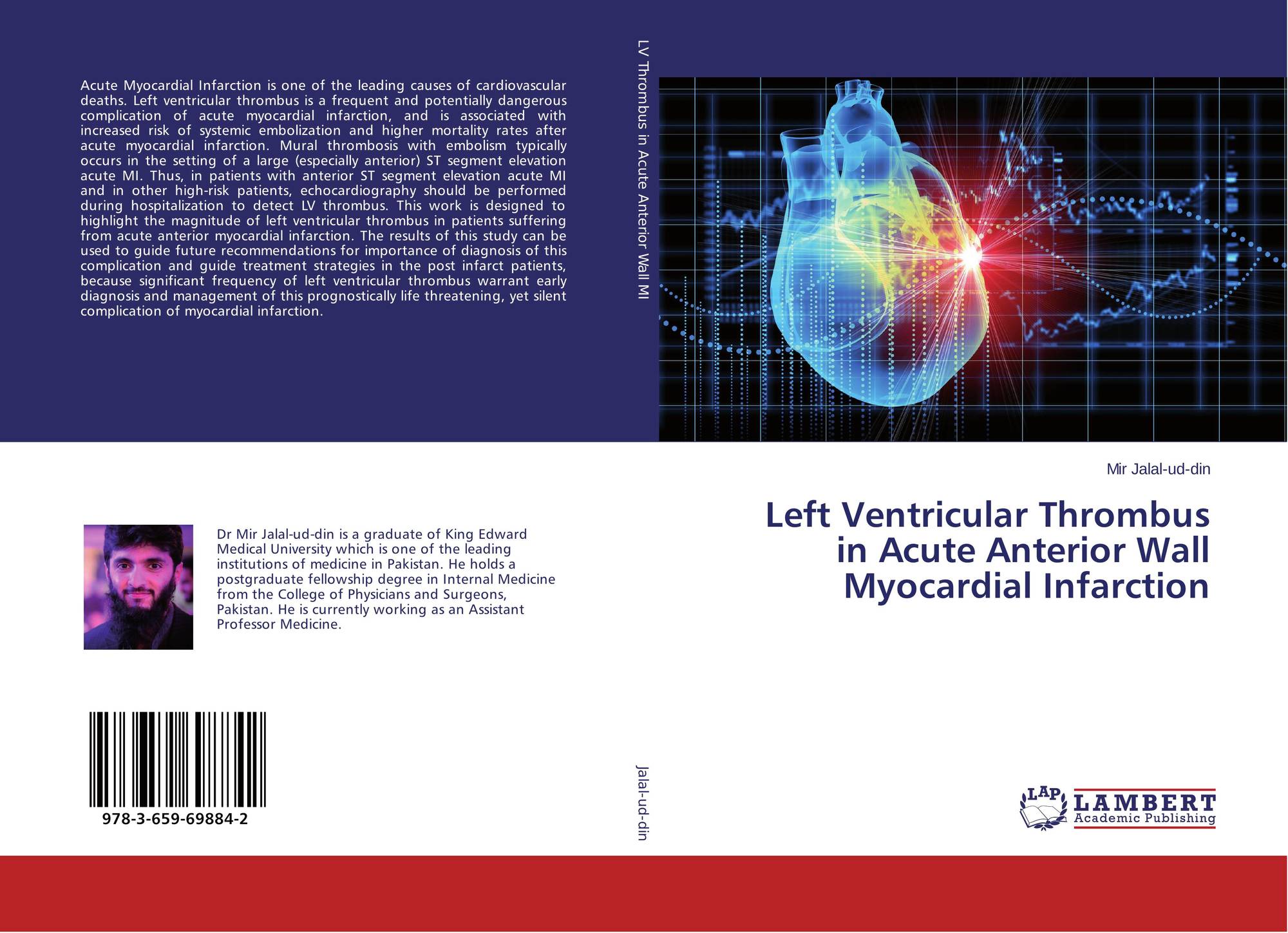 Left Ventricular Thrombus in Acute Anterior Wall Myocardial Infarction / 978-3-659-69884-2 ...