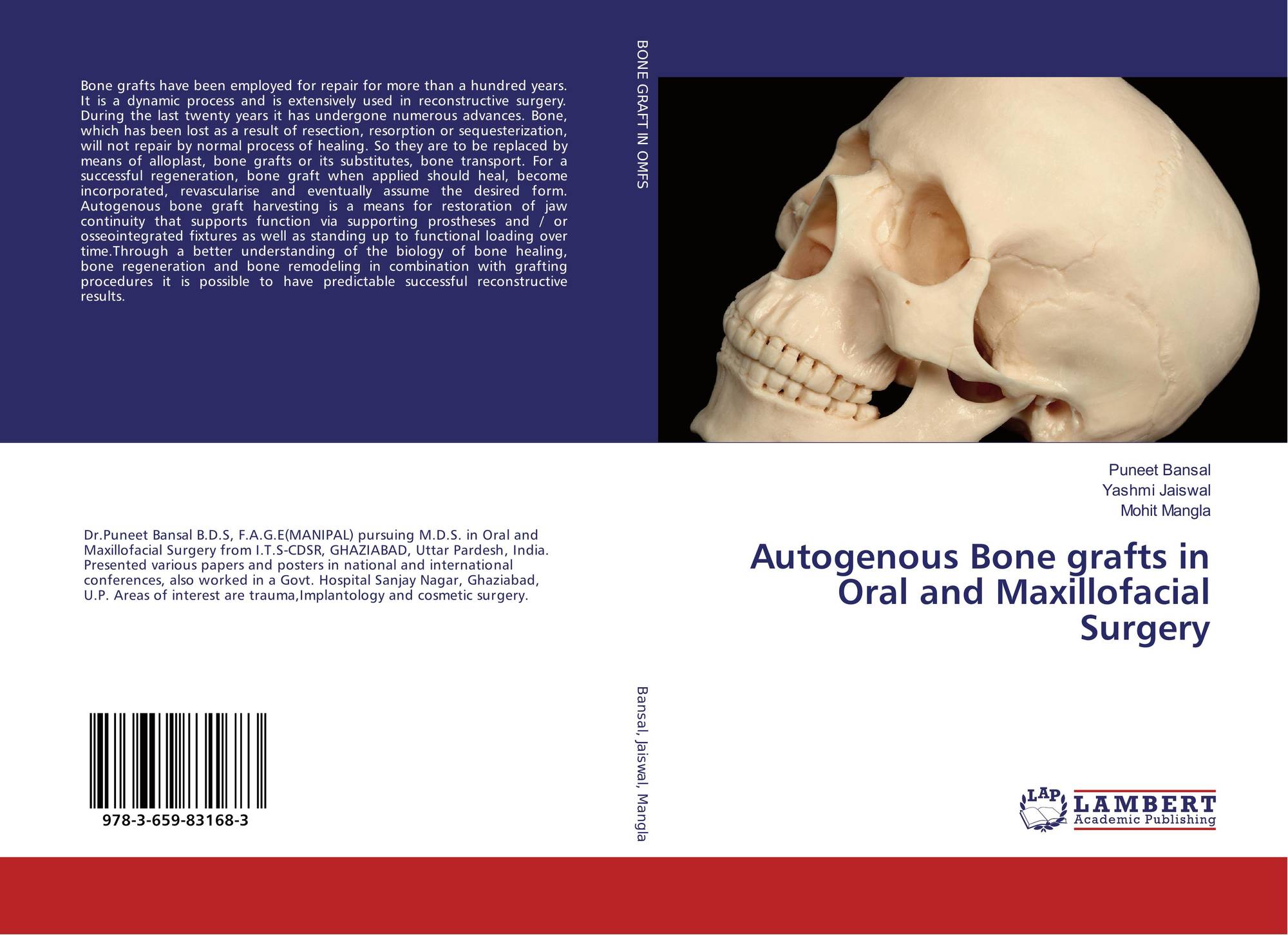 Autogenous Bone grafts in Oral and Maxillofacial Surgery, 9783659