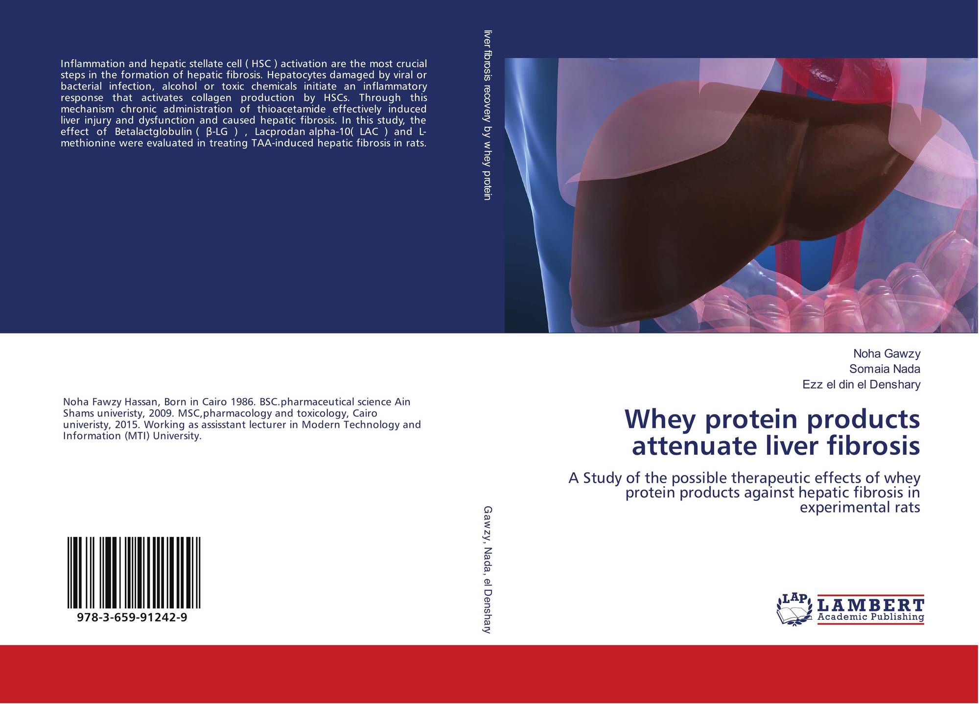 Whey protein products attenuate liver fibrosis, 9783659912429