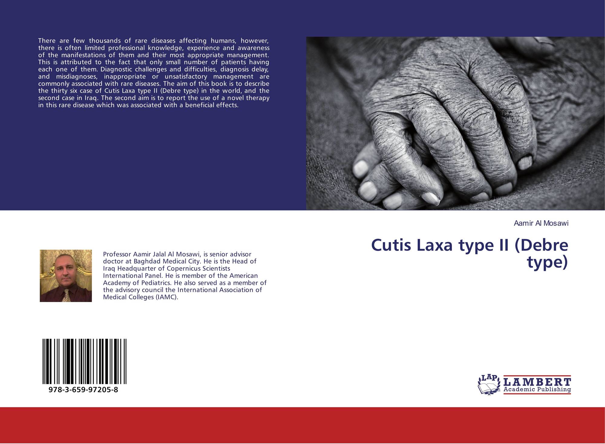 cutis laxa type 3