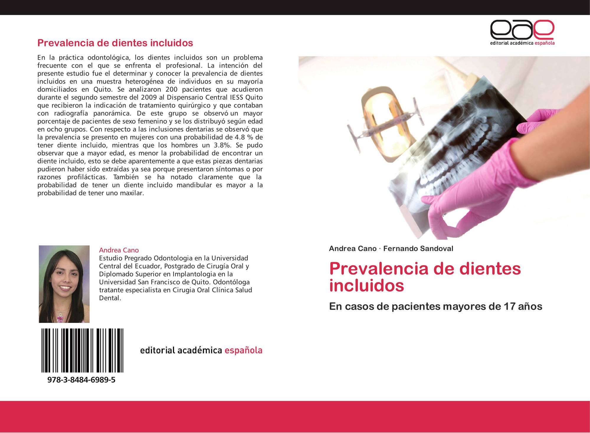 Prevalencia De Dientes Incluidos 978 3 8484 6989 5 3848469898 9783848469895 By Andrea Cano Fernando Sandoval
