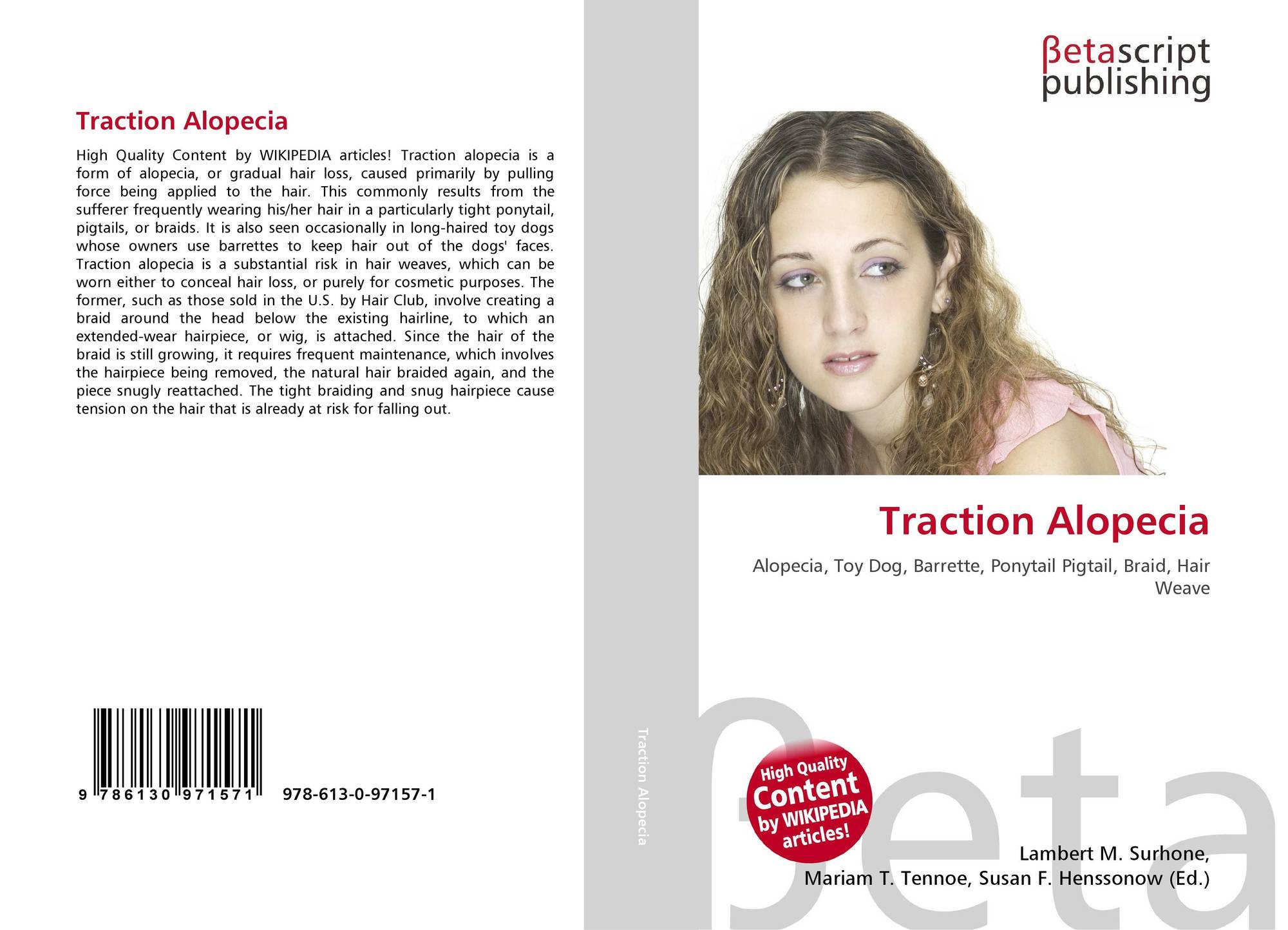 Traction Alopecia 978 613 0 97157 1 6130971575 9786130971571