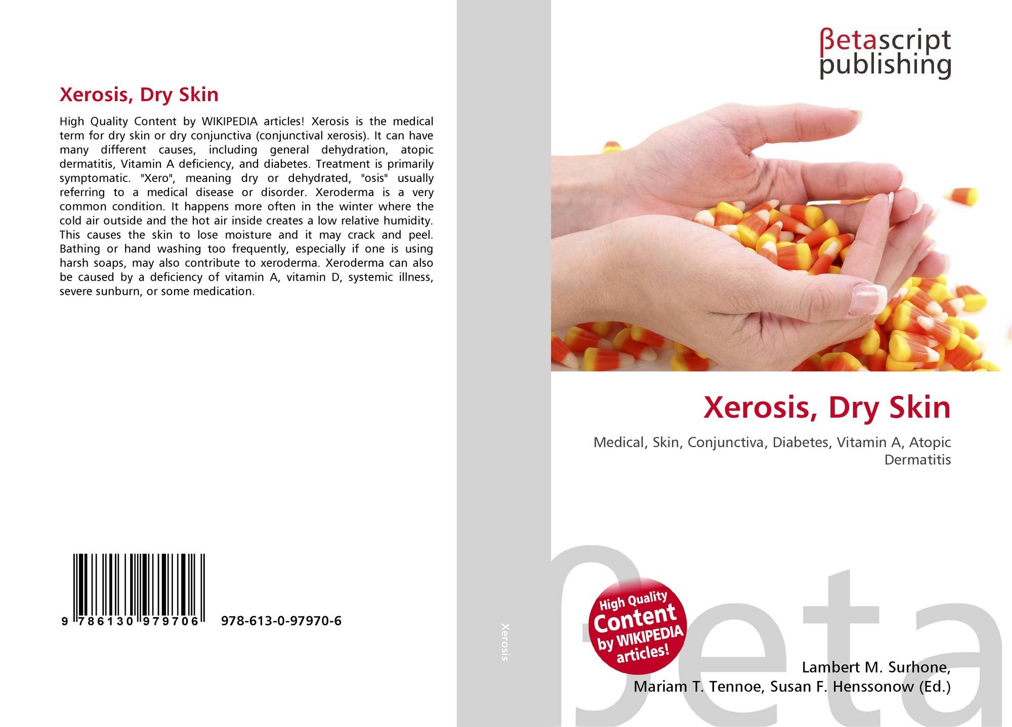 Xerosis Dry Skin 978 613 0 97970 6 6130979703 9786130979706