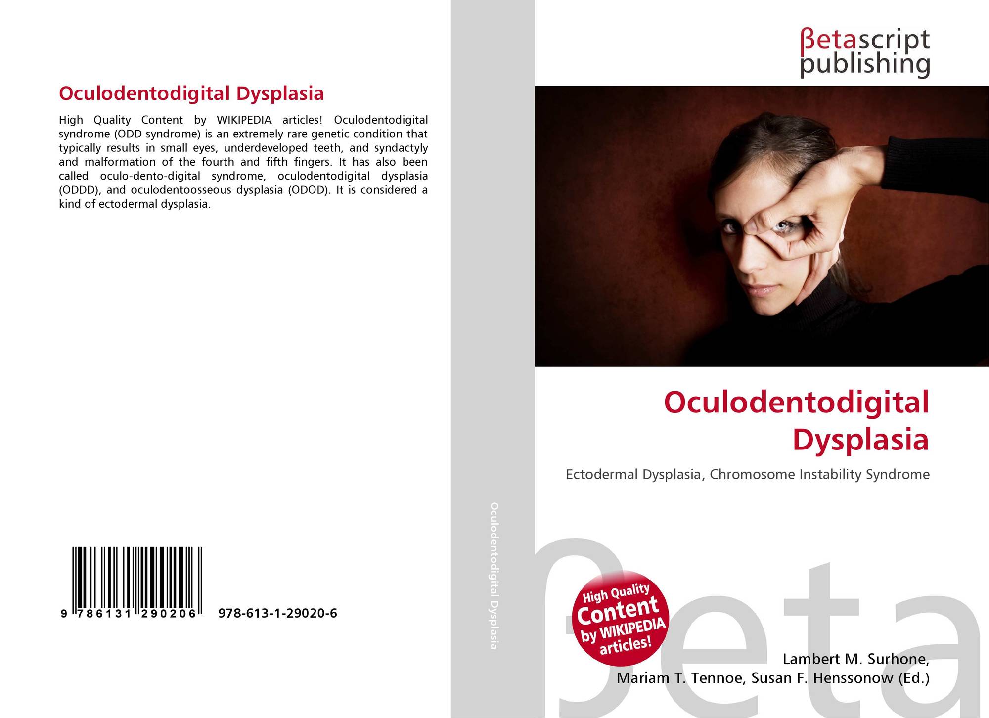 Search results for "Dysplasia"