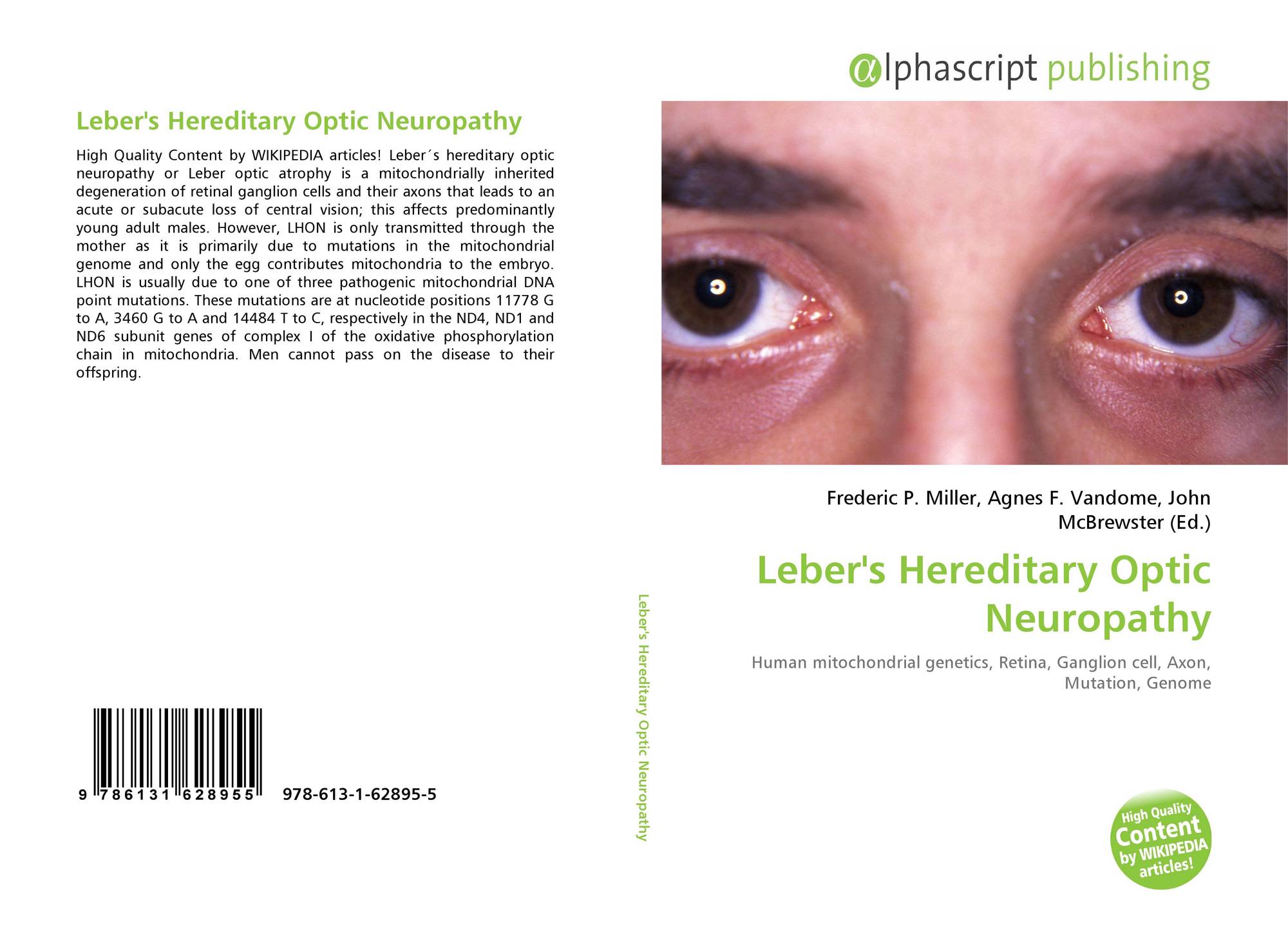 Leber's Hereditary Optic Neuropathy, 978-613-1-62895-5, 6131628955