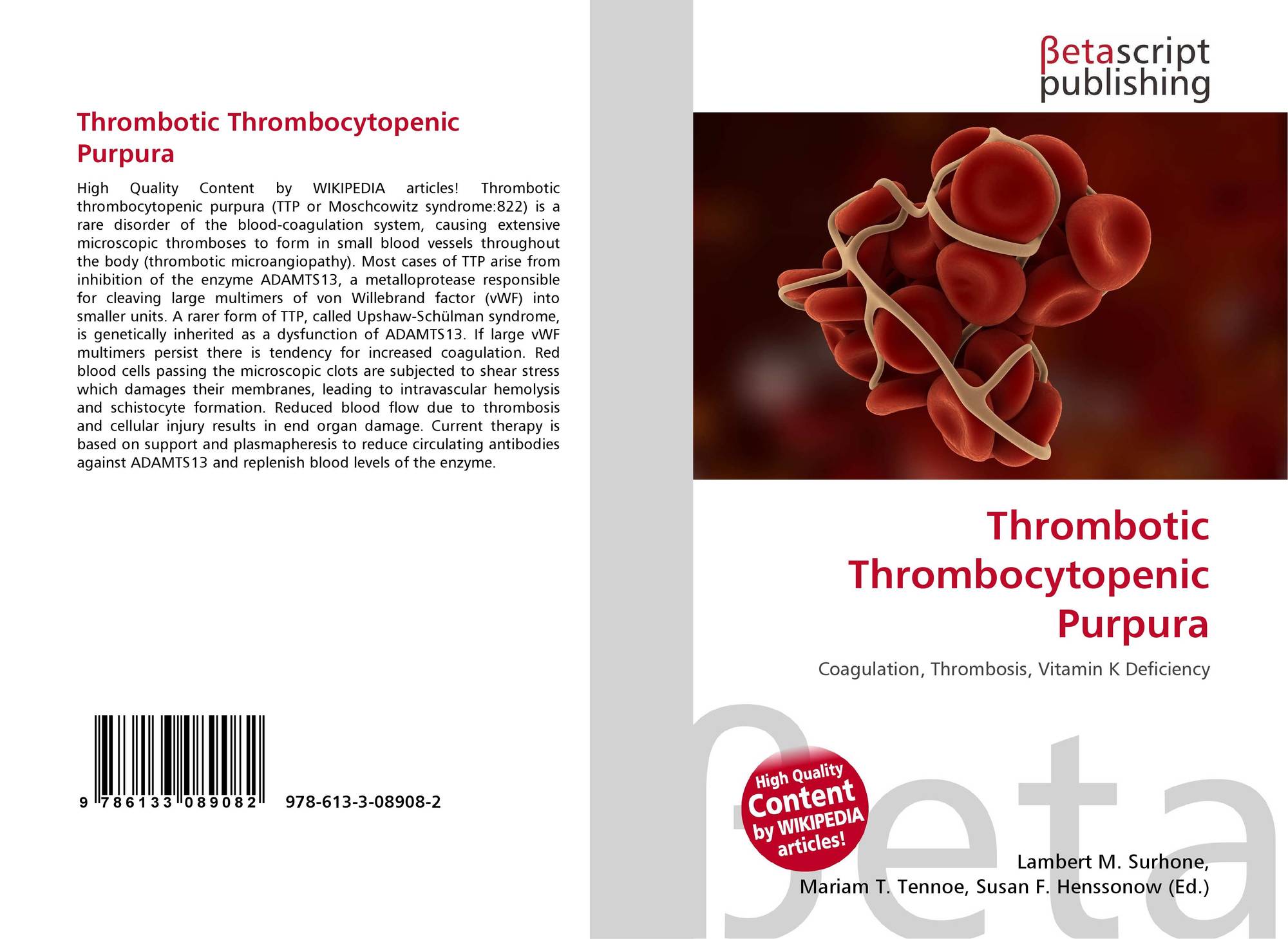Thrombotic thrombocytopenic purpura