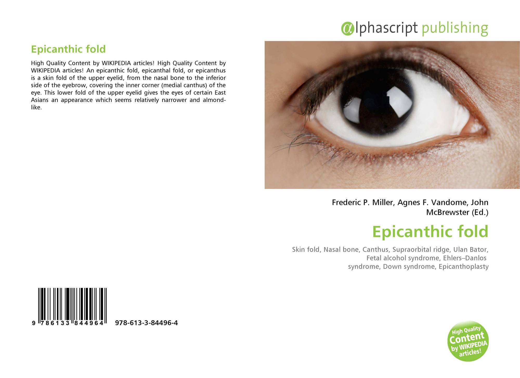 Epicanthic Fold 978 613 3 84496 4 6133844965 9786133844964