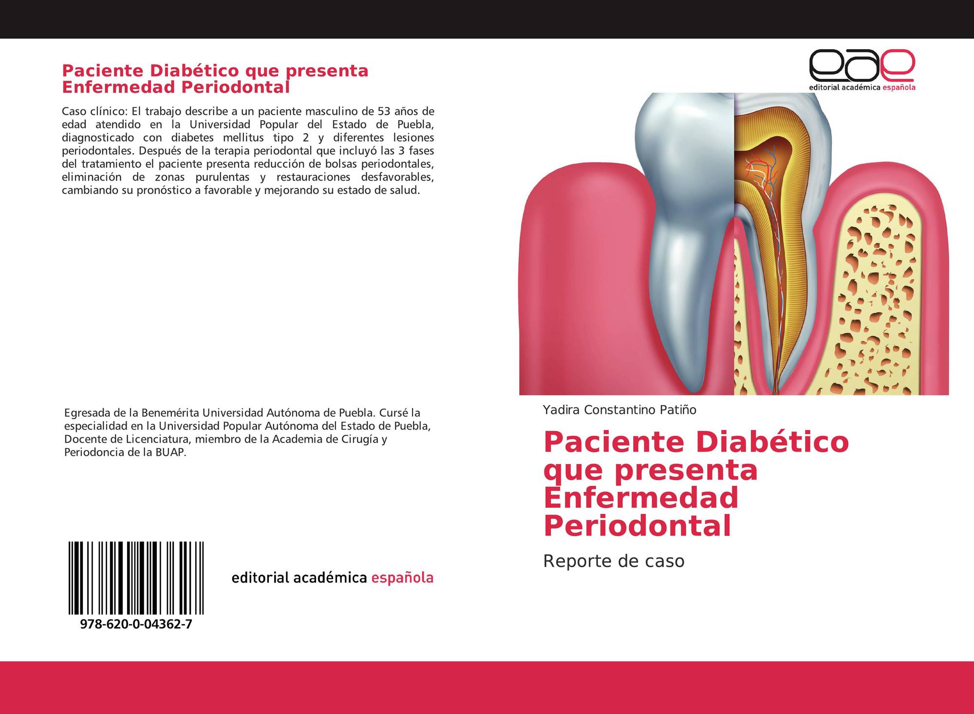pronóstico de diabetes mellitus tipo dos pronóstico de diabetes mellitus tipo dos