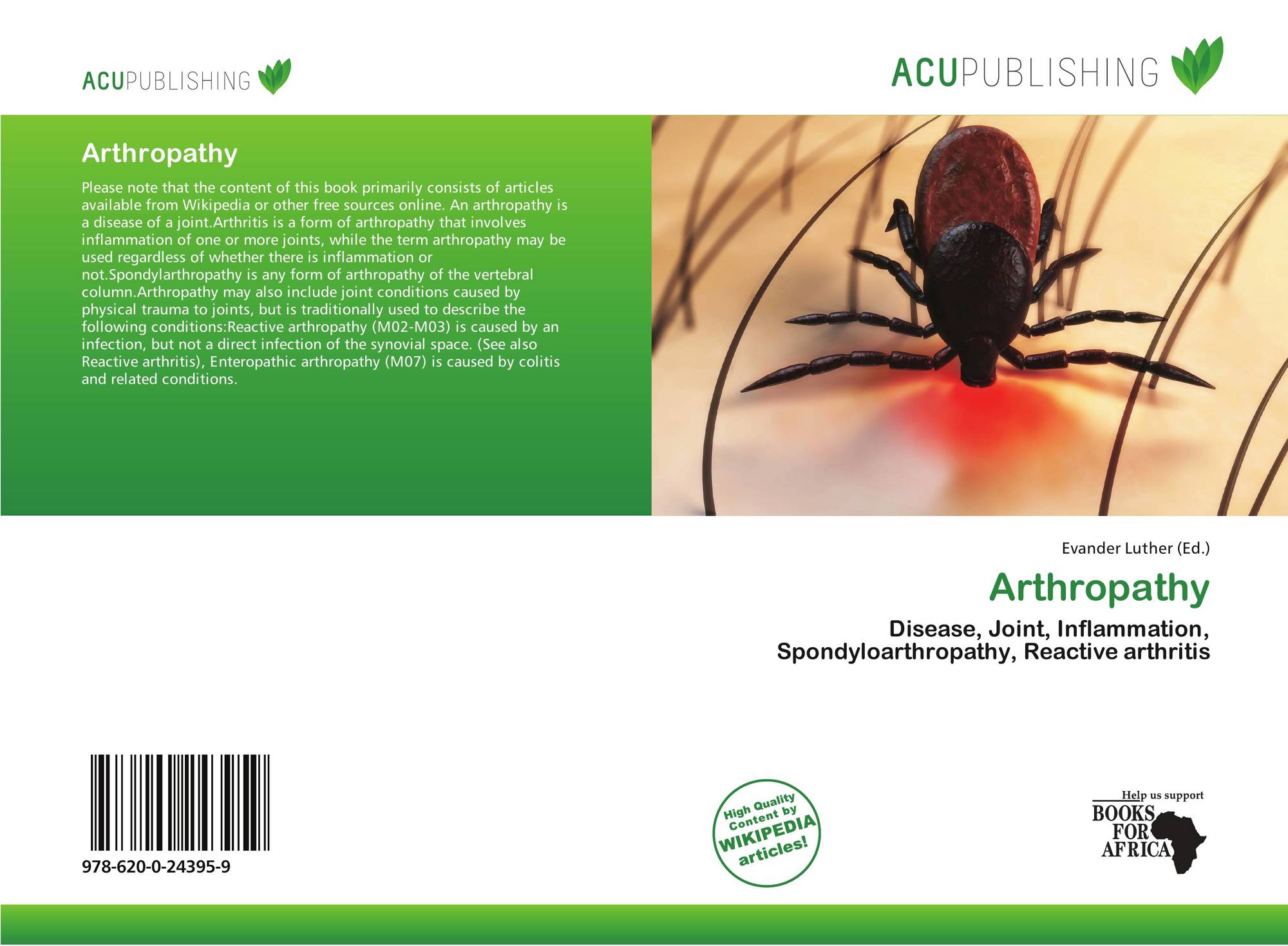 Search Results For spondyloarthropathy search-results-for-spondyloarthropathy