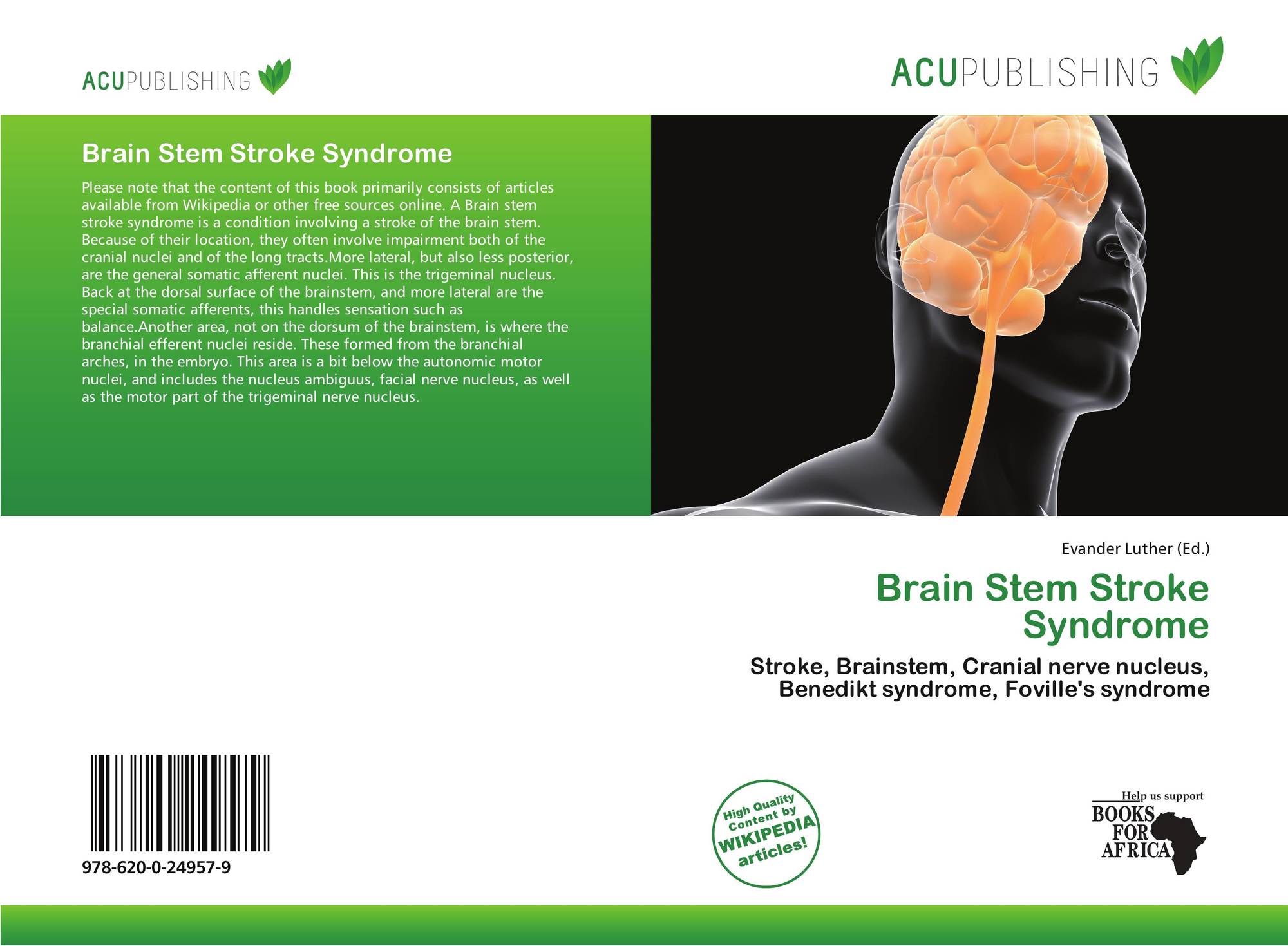 Brain Stem Stroke Syndrome 978 620 0 24957 9 6200249571 9786200249579