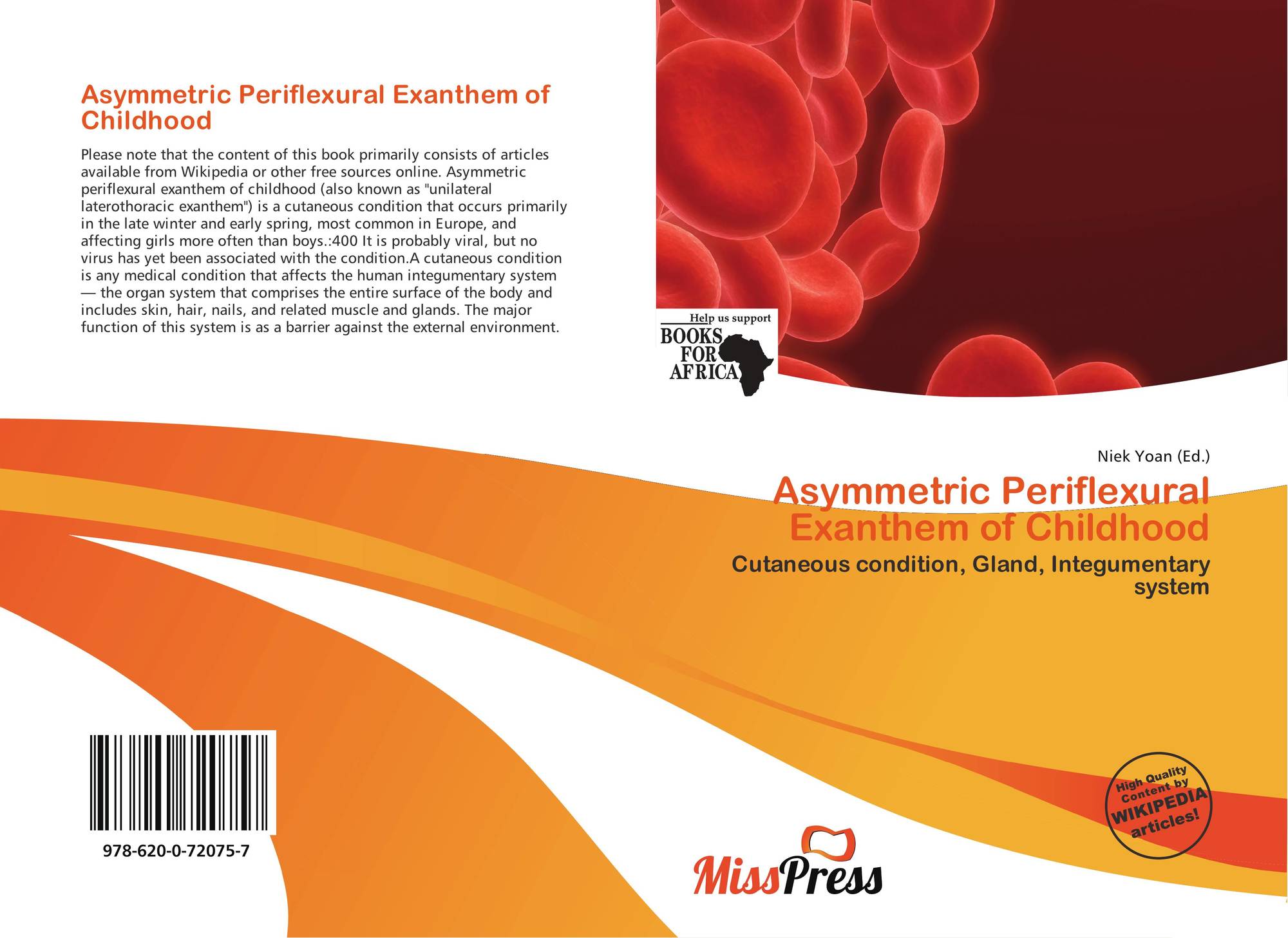 Visibility conditions value. Asymmetric Periflexural (unilateral Laterothoracic) Exanthem.