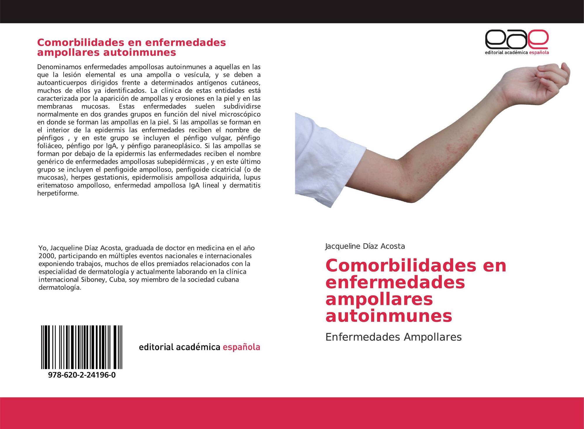 Comorbilidades En Enfermedades Ampollares Autoinmunes 978 620 2 24196 0 6202241969 9786202241960 By Jacqueline Diaz Acosta