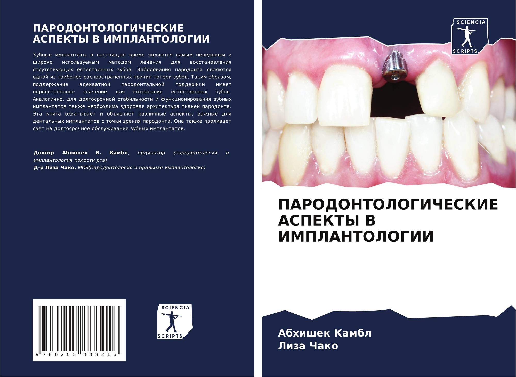 Установка импланта зуба отзывы пациентов. Ошибки и осложнения дентальной имплантации. Осложнения при имплантации.