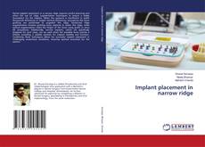 Buchcover von Implant placement in narrow ridge