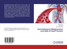 Bookcover of Hematological Malignancies and Role of Rab7 Protein