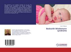 Buchcover von Beckwith Wiedemann syndrome