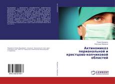 Copertina di Актиномикоз перианальной и крестцово-копчиковой областей