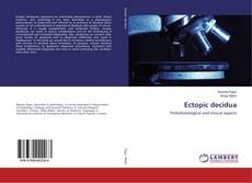 Bookcover of Ectopic decidua