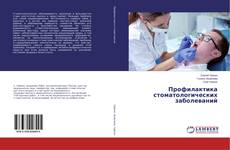 Buchcover von Профилактика стоматологических заболеваний