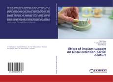 Bookcover of Effect of implant support on Distal extention partial denture