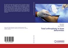 Bookcover of Total arthroplasty in knee deformities