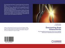 Copertina di Overcoming Knee Osteoarthritis